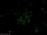 IMP3 Antibody in Immunocytochemistry (ICC/IF)