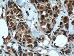 IMP3 Antibody in Immunohistochemistry (Paraffin) (IHC (P))