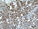 IMP3 Antibody in Immunohistochemistry (Paraffin) (IHC (P))