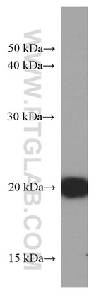 IMP3 Antibody in Western Blot (WB)