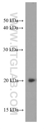 IMP3 Antibody in Western Blot (WB)