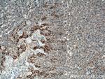 PD-L1/CD274 Antibody in Immunohistochemistry (Paraffin) (IHC (P))