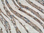 PD-L1/CD274 Antibody in Immunohistochemistry (Paraffin) (IHC (P))