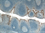 PD-L1/CD274 Antibody in Immunohistochemistry (Paraffin) (IHC (P))