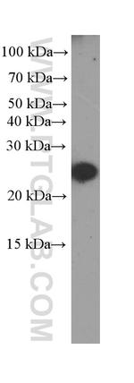 CRP Antibody in Western Blot (WB)