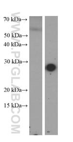 CRP Antibody in Western Blot (WB)