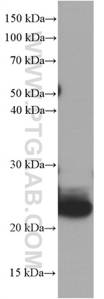 CRP Antibody in Western Blot (WB)