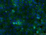 GNAS Antibody in Immunocytochemistry (ICC/IF)