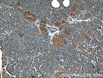 GNAS Antibody in Immunohistochemistry (Paraffin) (IHC (P))