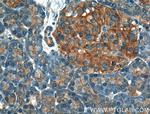 GNAS Antibody in Immunohistochemistry (Paraffin) (IHC (P))