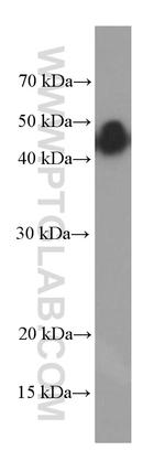 GNAS Antibody in Western Blot (WB)