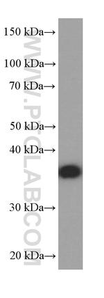 PHOX2B Antibody in Western Blot (WB)