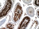 AKAP3 Antibody in Immunohistochemistry (Paraffin) (IHC (P))