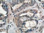 FAK Antibody in Immunohistochemistry (Paraffin) (IHC (P))