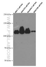 FAK Antibody in Western Blot (WB)