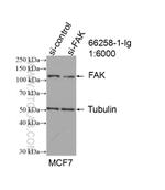 FAK Antibody in Western Blot (WB)