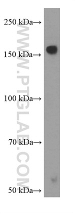 Nestin Antibody in Western Blot (WB)