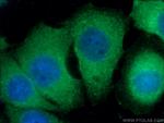 alpha-1B-glycoprotein Antibody in Immunocytochemistry (ICC/IF)