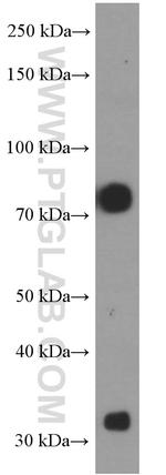 alpha-1B-glycoprotein Antibody in Western Blot (WB)