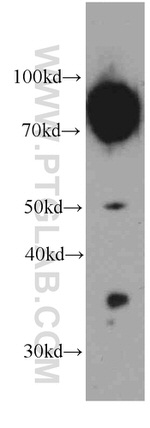 alpha-1B-glycoprotein Antibody in Western Blot (WB)