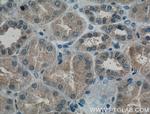 PAI-1 Antibody in Immunohistochemistry (Paraffin) (IHC (P))