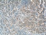 FRS2 Antibody in Immunohistochemistry (Paraffin) (IHC (P))