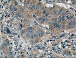 FRS2 Antibody in Immunohistochemistry (Paraffin) (IHC (P))