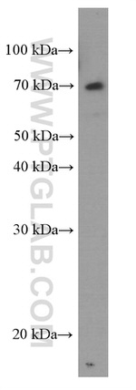 FRS2 Antibody in Western Blot (WB)