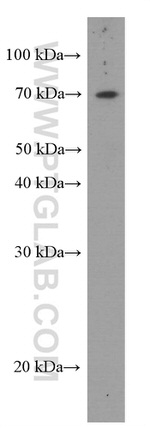 FRS2 Antibody in Western Blot (WB)