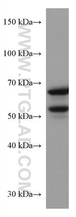 GLS Antibody in Western Blot (WB)