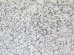 GLS Antibody in Immunohistochemistry (Paraffin) (IHC (P))