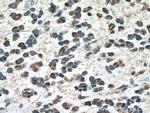 GLS Antibody in Immunohistochemistry (Paraffin) (IHC (P))