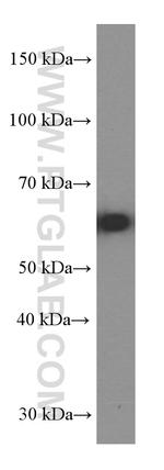 GLS Antibody in Western Blot (WB)