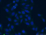 GLS Antibody in Immunocytochemistry (ICC/IF)