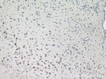 GLS Antibody in Immunohistochemistry (Paraffin) (IHC (P))