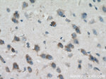 GLS Antibody in Immunohistochemistry (Paraffin) (IHC (P))