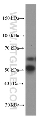 GLS Antibody in Western Blot (WB)