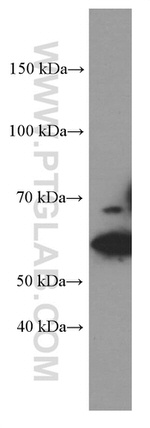 GLS Antibody in Western Blot (WB)