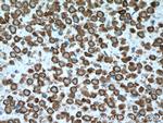 SRPX2 Antibody in Immunohistochemistry (Paraffin) (IHC (P))