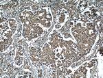 L2HGDH Antibody in Immunohistochemistry (Paraffin) (IHC (P))