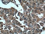 L2HGDH Antibody in Immunohistochemistry (Paraffin) (IHC (P))