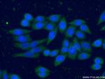 CAPG Antibody in Immunocytochemistry (ICC/IF)