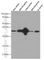 CDK6 Antibody in Western Blot (WB)