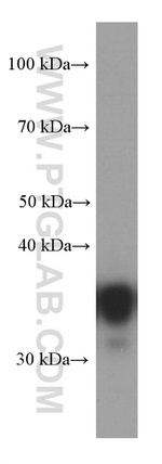 CDK6 Antibody in Western Blot (WB)