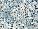 ZEB1 Antibody in Immunohistochemistry (Paraffin) (IHC (P))