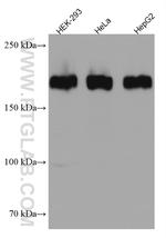 ZEB1 Antibody in Western Blot (WB)