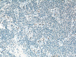 ZEB1 Antibody in Immunohistochemistry (Paraffin) (IHC (P))