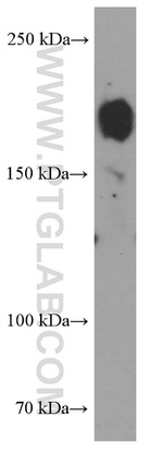 ZEB1 Antibody in Western Blot (WB)