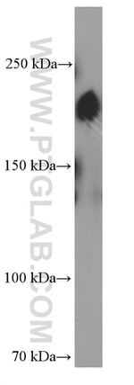 ZEB1 Antibody in Western Blot (WB)