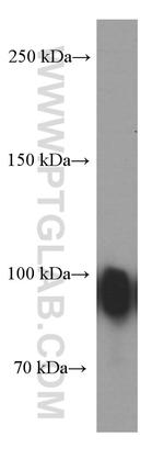 Gelsolin Antibody in Western Blot (WB)